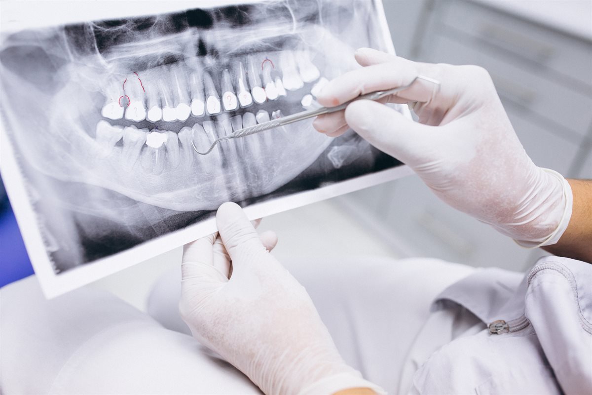 Radiologie dentară la clinica Art of Dentology